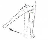 Gluteal Tendinopathy