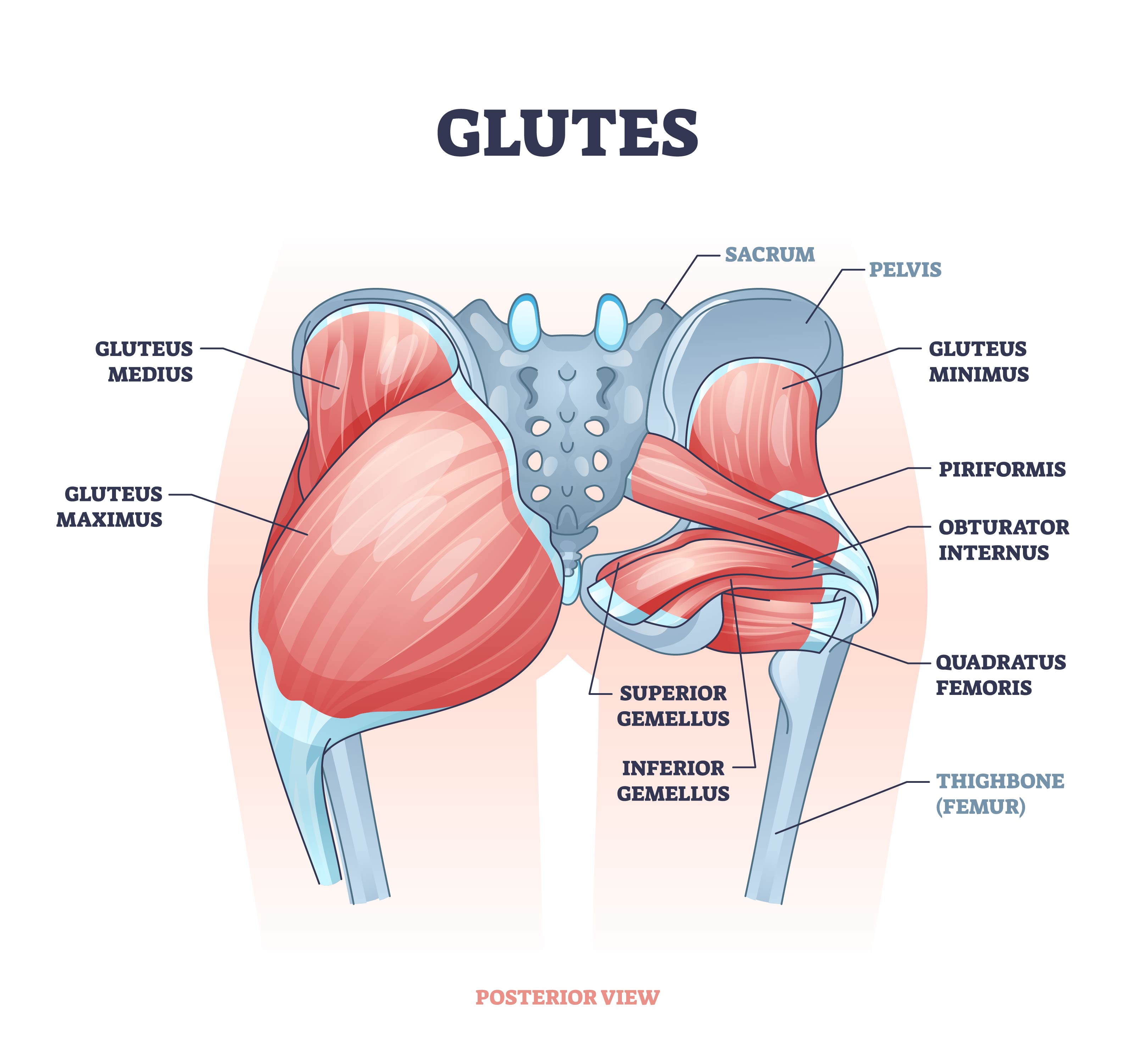 Gluteal Tendinopathy