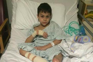 Life changing surgery for war wounded child